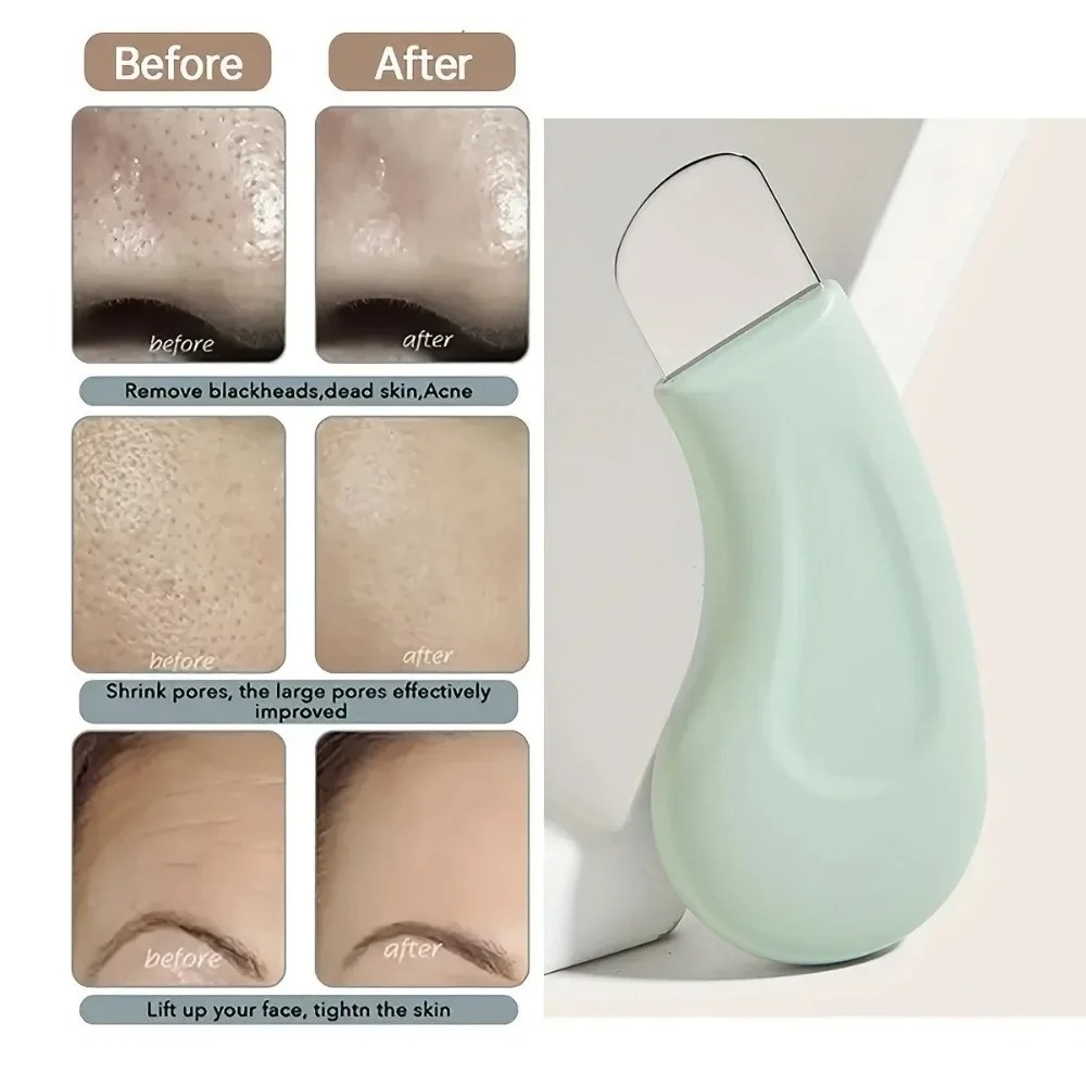 Deep Cleansing Blackhead White - Skincare Scora recension och pris