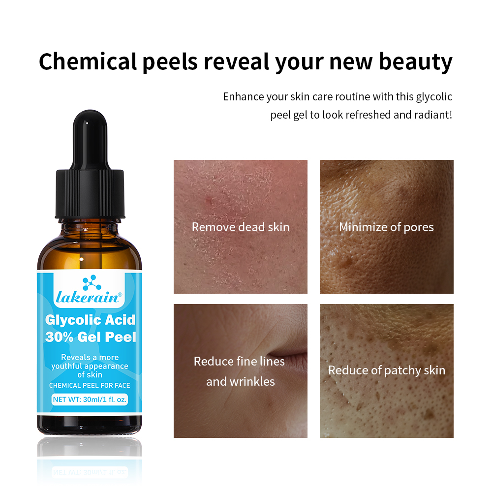 30% Glycolic Acid Peel Gel Pro - Glycolic Acid Exfoliant recension och pris