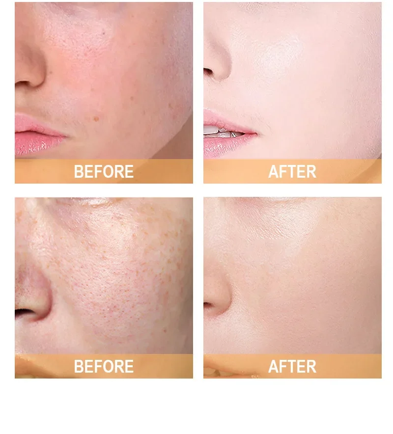 7% Glycolic Acid Toning Soluti - Glycolic Acid Exfoliant recension och pris