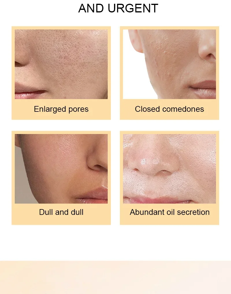 7% Glycolic Acid Toning Soluti - Glycolic Acid Exfoliant recension och pris