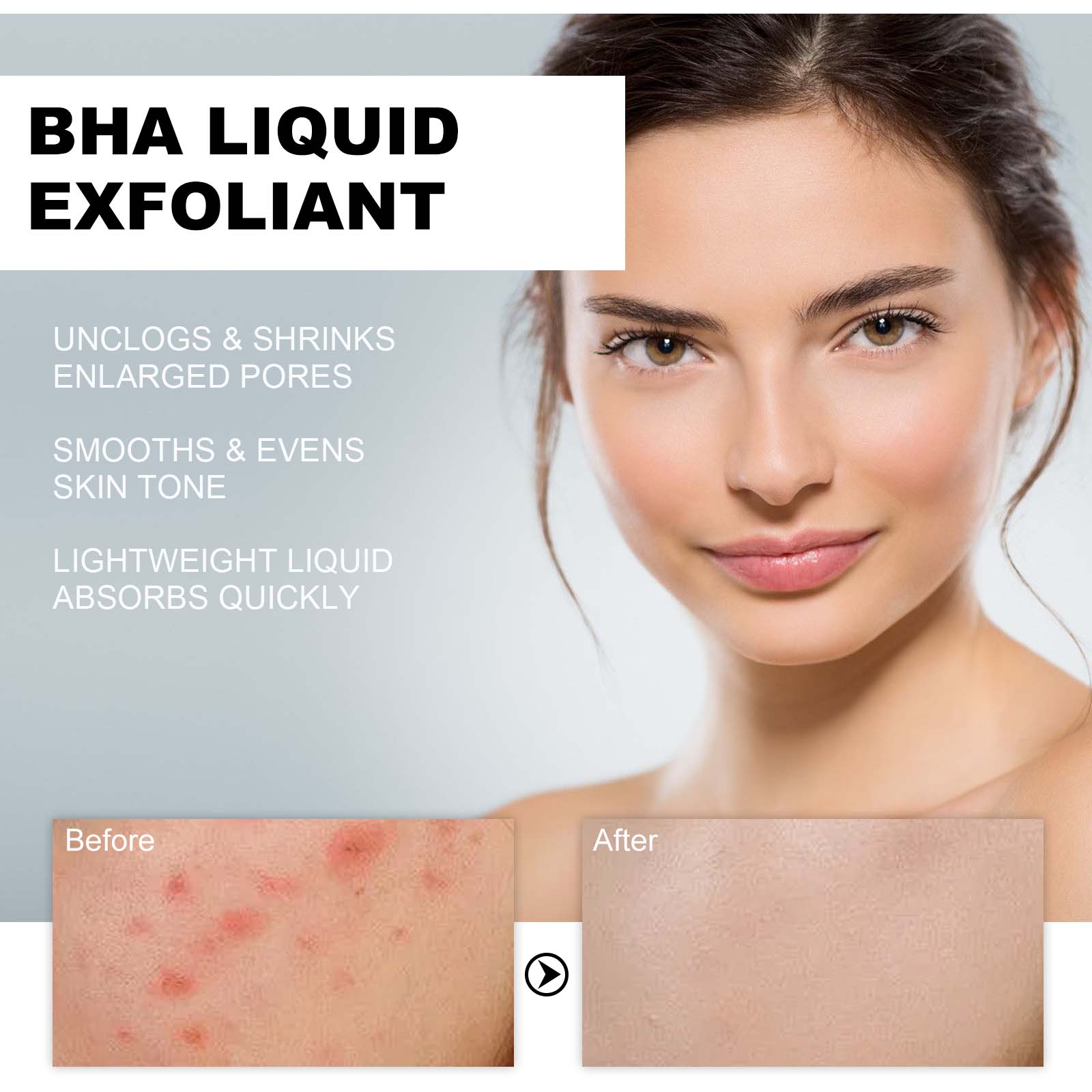 2% Salicylic Acid Liquid Exfol - Glycolic Acid Exfoliant recension och pris