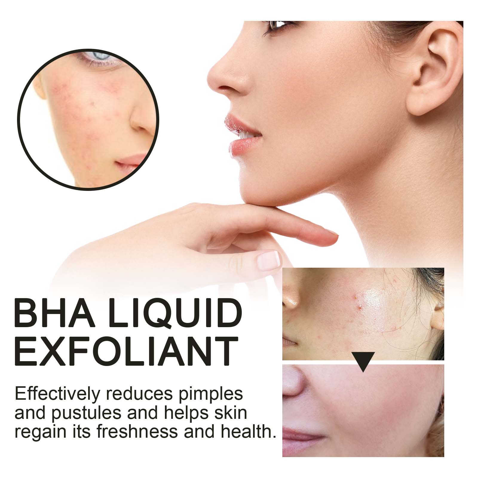 2% Salicylic Acid Liquid Exfol - Glycolic Acid Exfoliant recension och pris