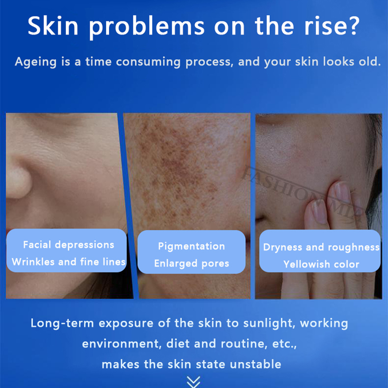 80% Blue Sponge microalgae Kit - Skincare Collagen recension och pris